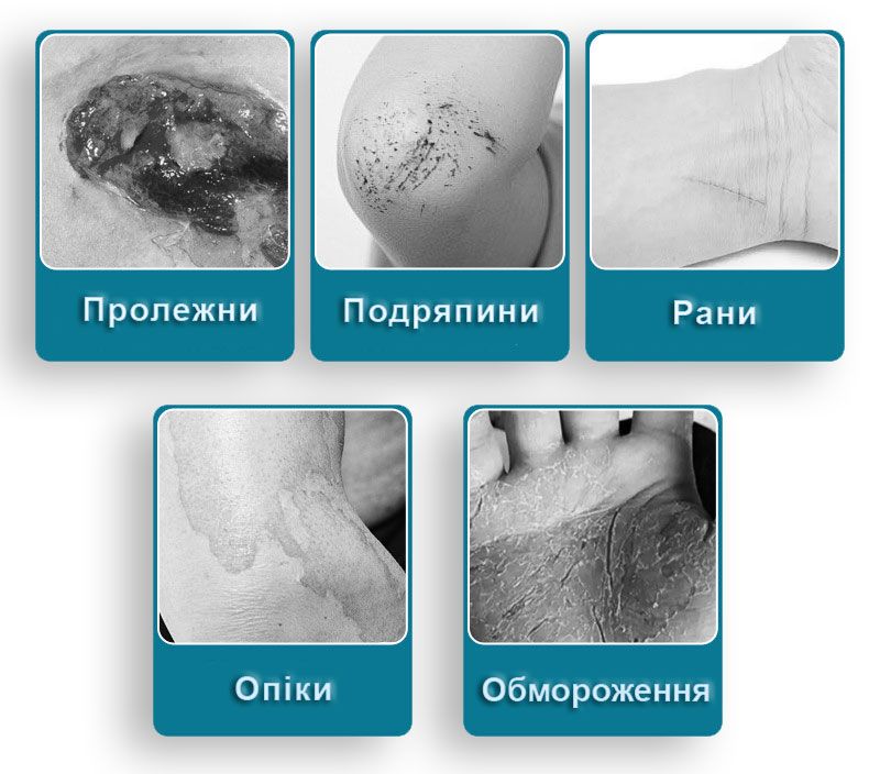 Гель с серебром ᐉ Антибактериальный ᐉ Ранозаживляющий