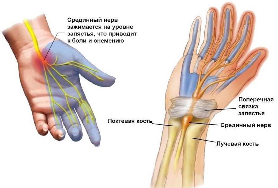 Масажер для рук ᐉ Фізіотерапевтичний ᐉ З прогріванням та пресотерапією
