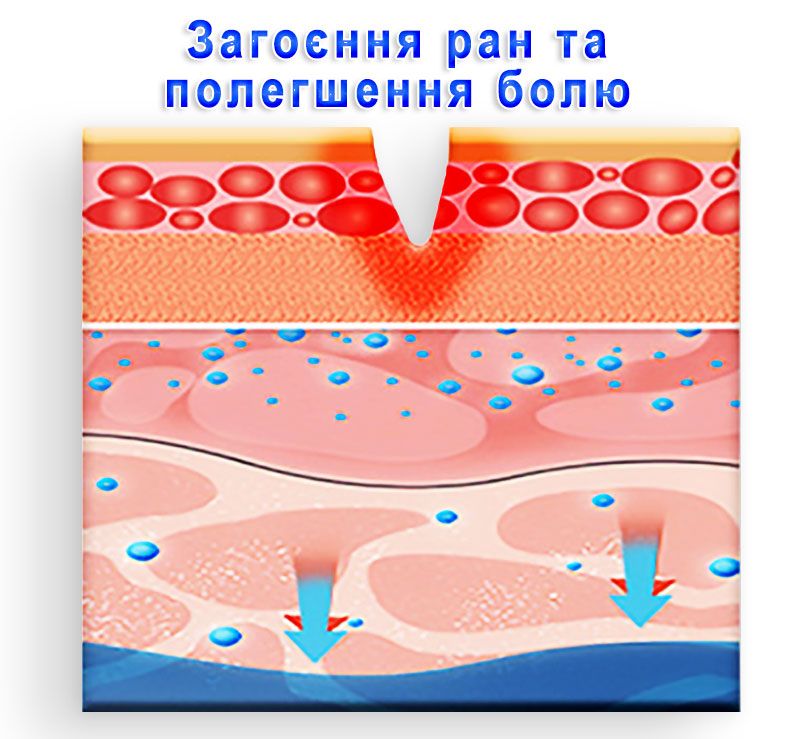 Гель альгинатный ᐉ Антибактериальный