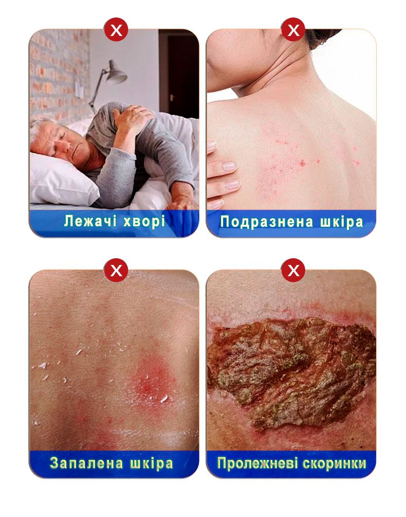 Крем ᐉ От пролежней ᐉ От трофических язв