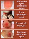 Гель с массажным роллером ᐉ Для щитовидной железы