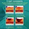 Повязка-компресс альгинатная ᐉ Раневая ᐉ Противопролежневая ᐉ 5 см х 5 см