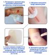Пластырь ᐉ От пролежней ᐉ От трофических язв ᐉ Для копчика ᐉ 18 см х 18 см ᐉ Гидроколоидный