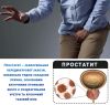 Пластырь ᐉ От простатита
