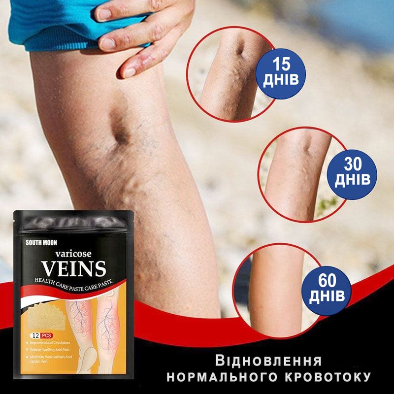 Varicose Veins ᐉ Пластырь ᐉ При варикозном расширении вен