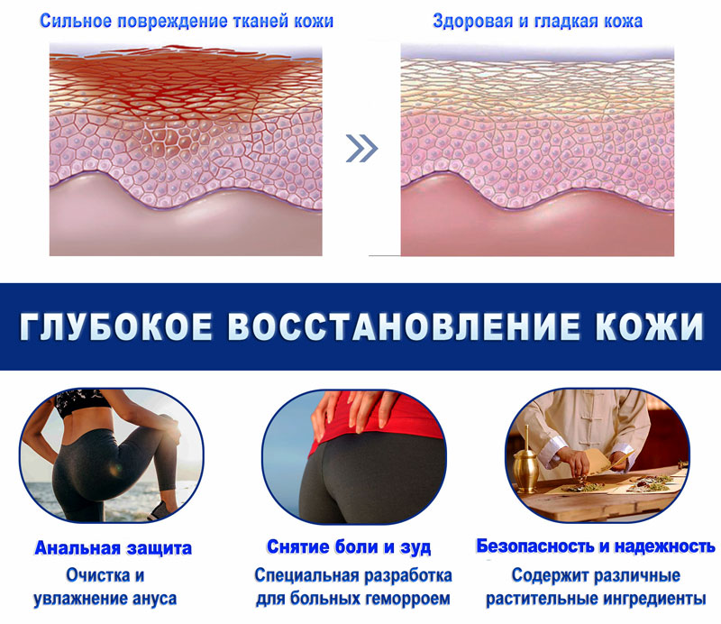 Капсулы от геморроя