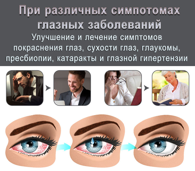 Капли для глаз 7,5 мл