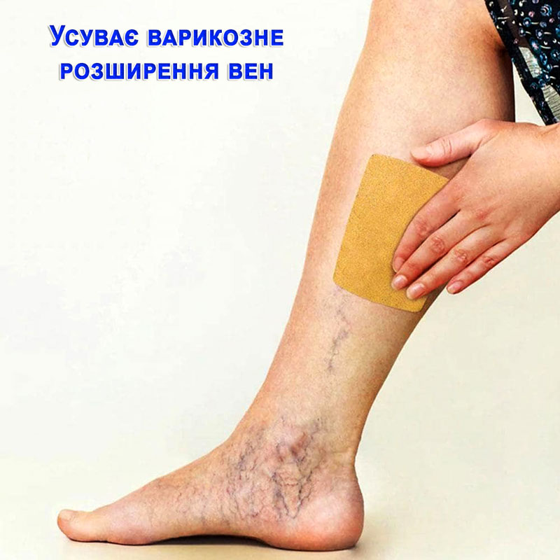 Пластир від варикозу інструкція