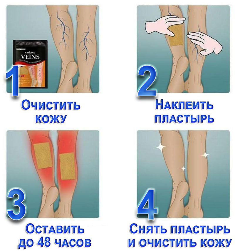 Пластырь от варикоза применение