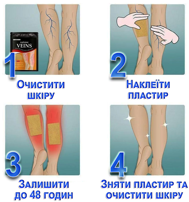 Пластир від варикозу застосування