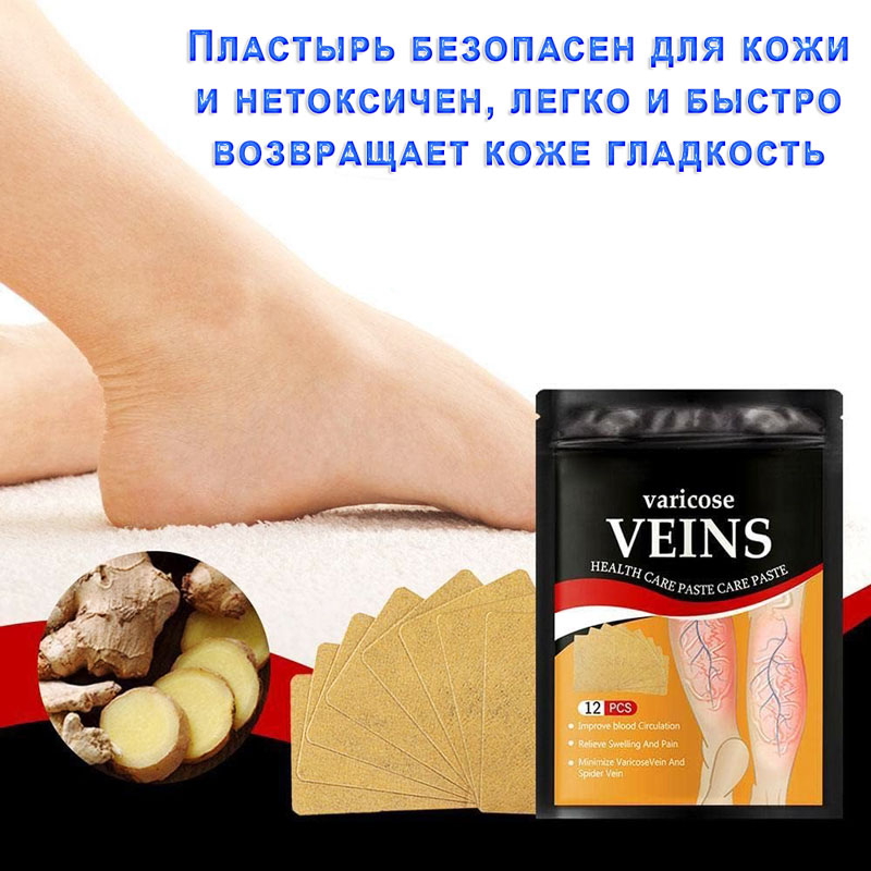 Пластырь при варикозе ног