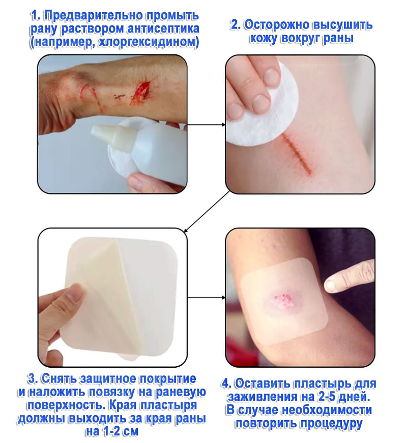 Пластырь противопролежневый гидроколлоидный
