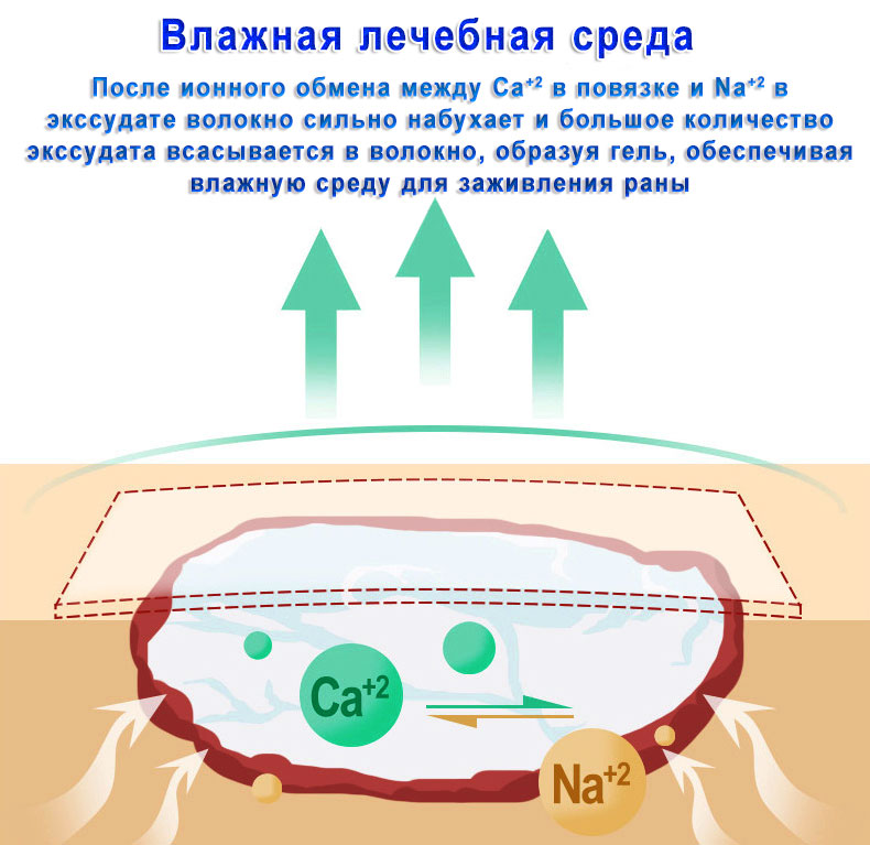 Альгинатная повязка